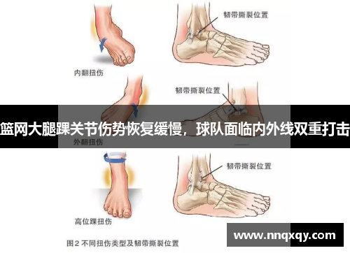 篮网大腿踝关节伤势恢复缓慢，球队面临内外线双重打击